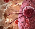 Mays Cancer Center conducts clinical trial combining two drugs in patients with recurrent, high-grade glioblastoma