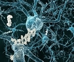 Research finds more depressed patients with activated immune systems than previously estimated